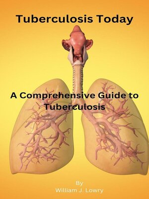 cover image of Tuberculosis Today